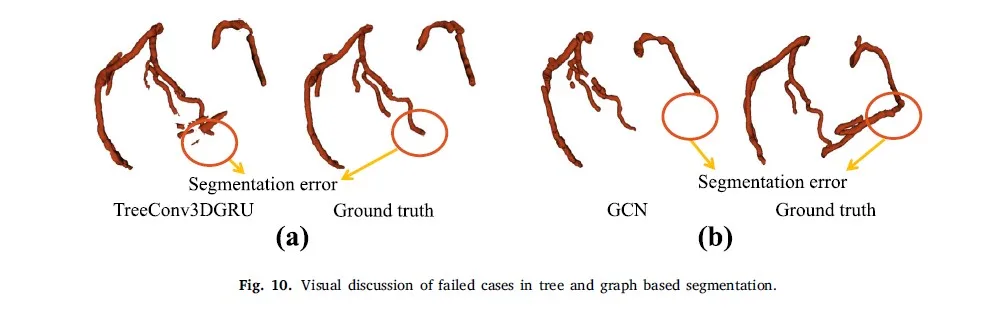 Ağaç ve grafik tabanlı segmentasyon